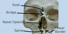 Nasal Bones