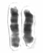 Chromosome 15