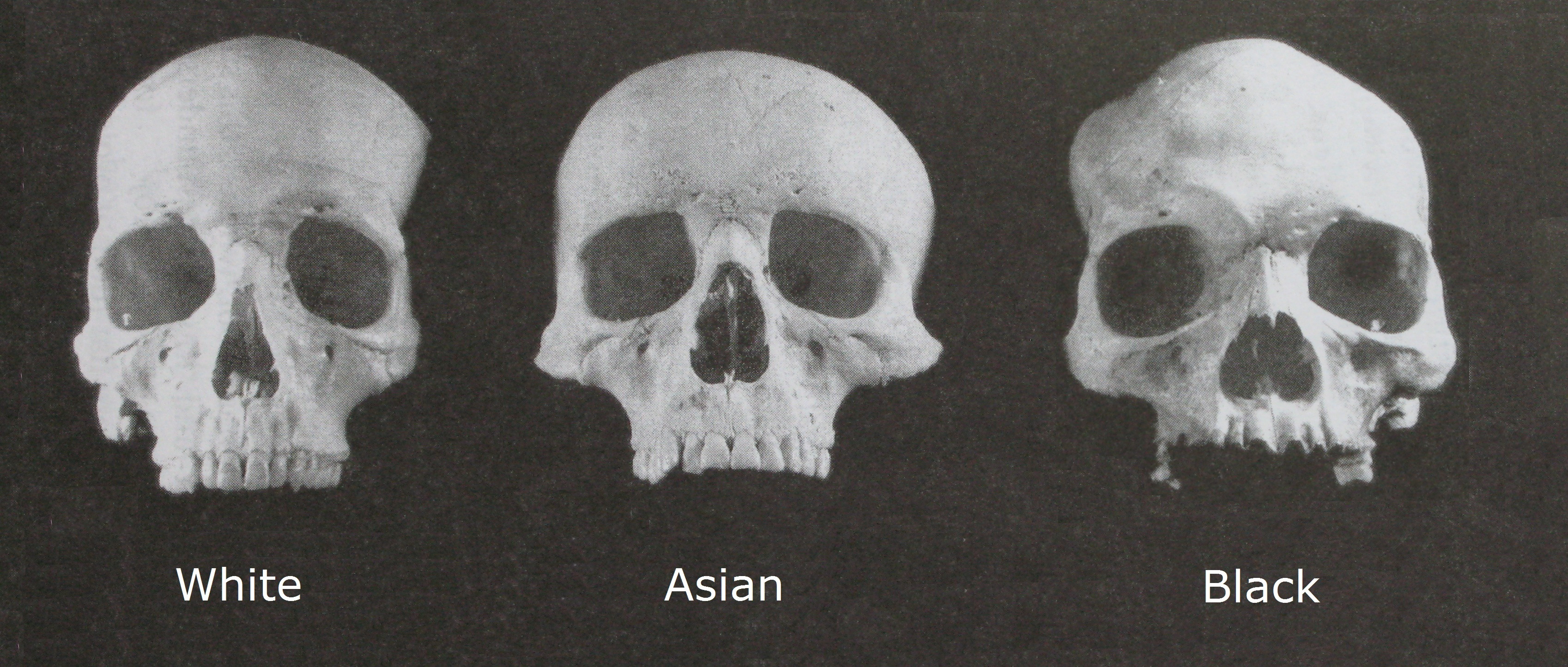 Human Differentiation Evolution Of Racial Characteristics